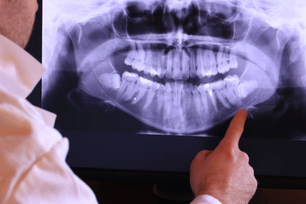 Best Emergency Treatment for Dental Infections or Abscesses in Ham Lake, MN