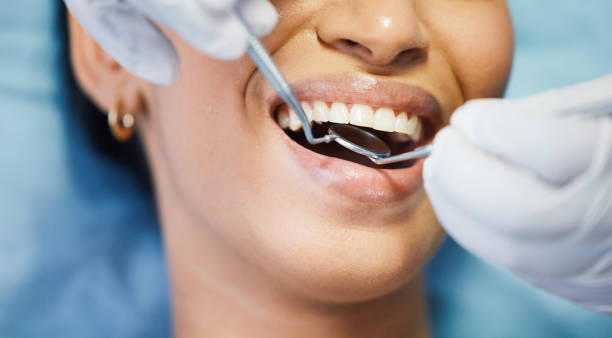 Best Emergency Dental Care for Broken or Chipped Teeth in Ham Lake, MN