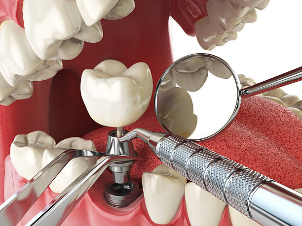 Best After-Hours Dental Trauma Care in Ham Lake, MN